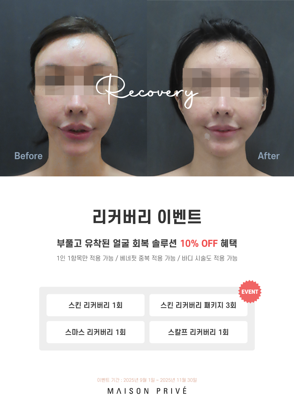 2509 리커버리 이벤트01